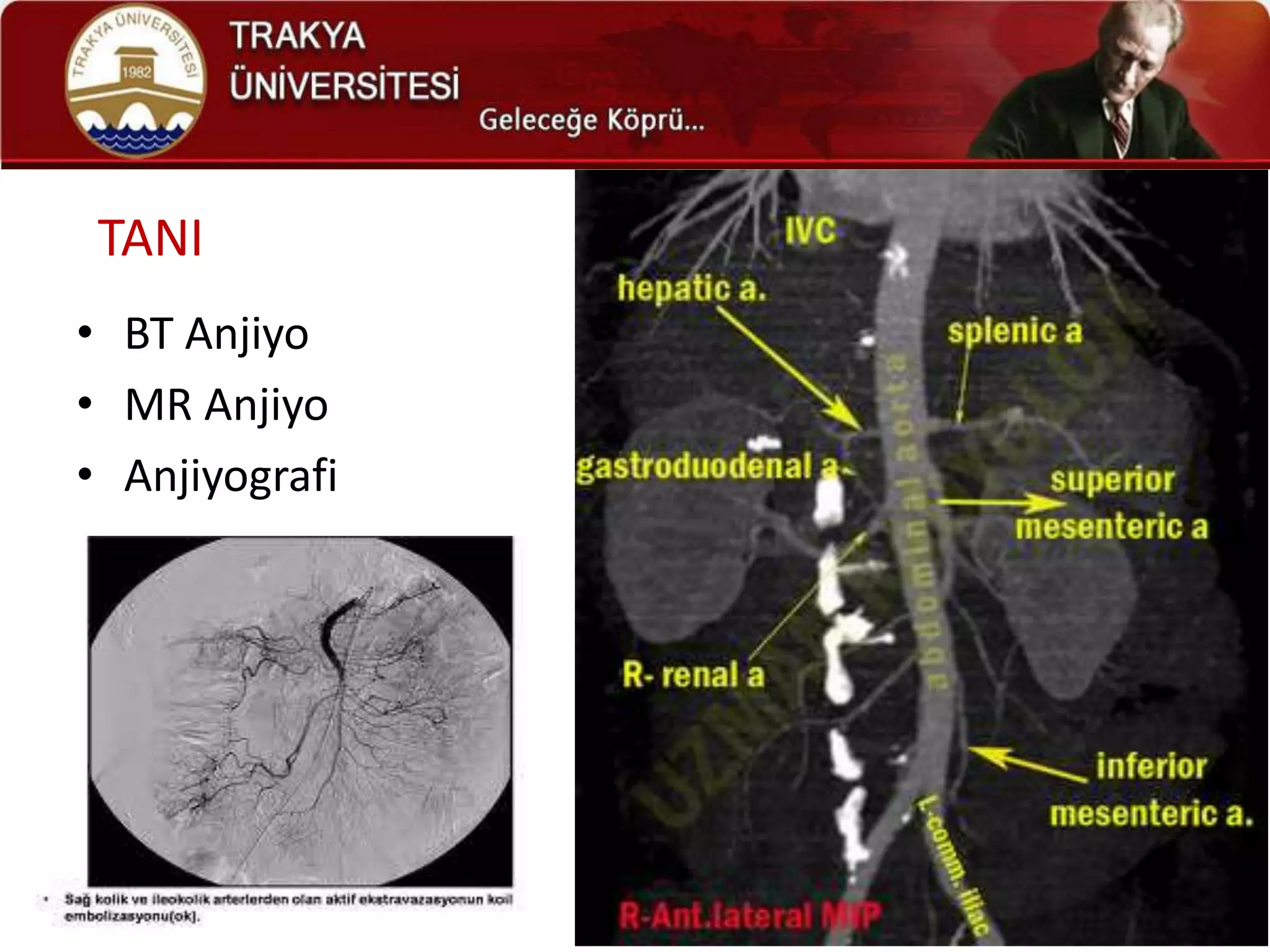 TANI
• BT Anjiyo
• MR Anjiyo
• Anjiyografi
 