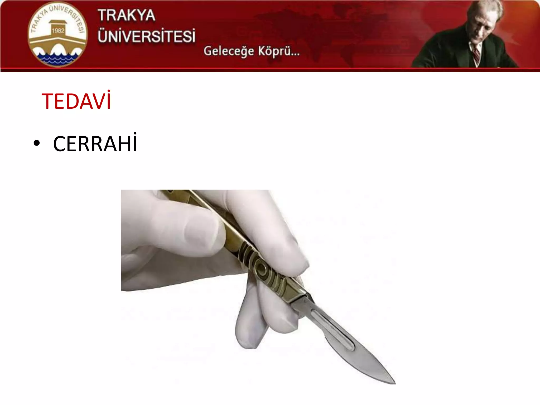 TEDAVİ
• CERRAHİ
 