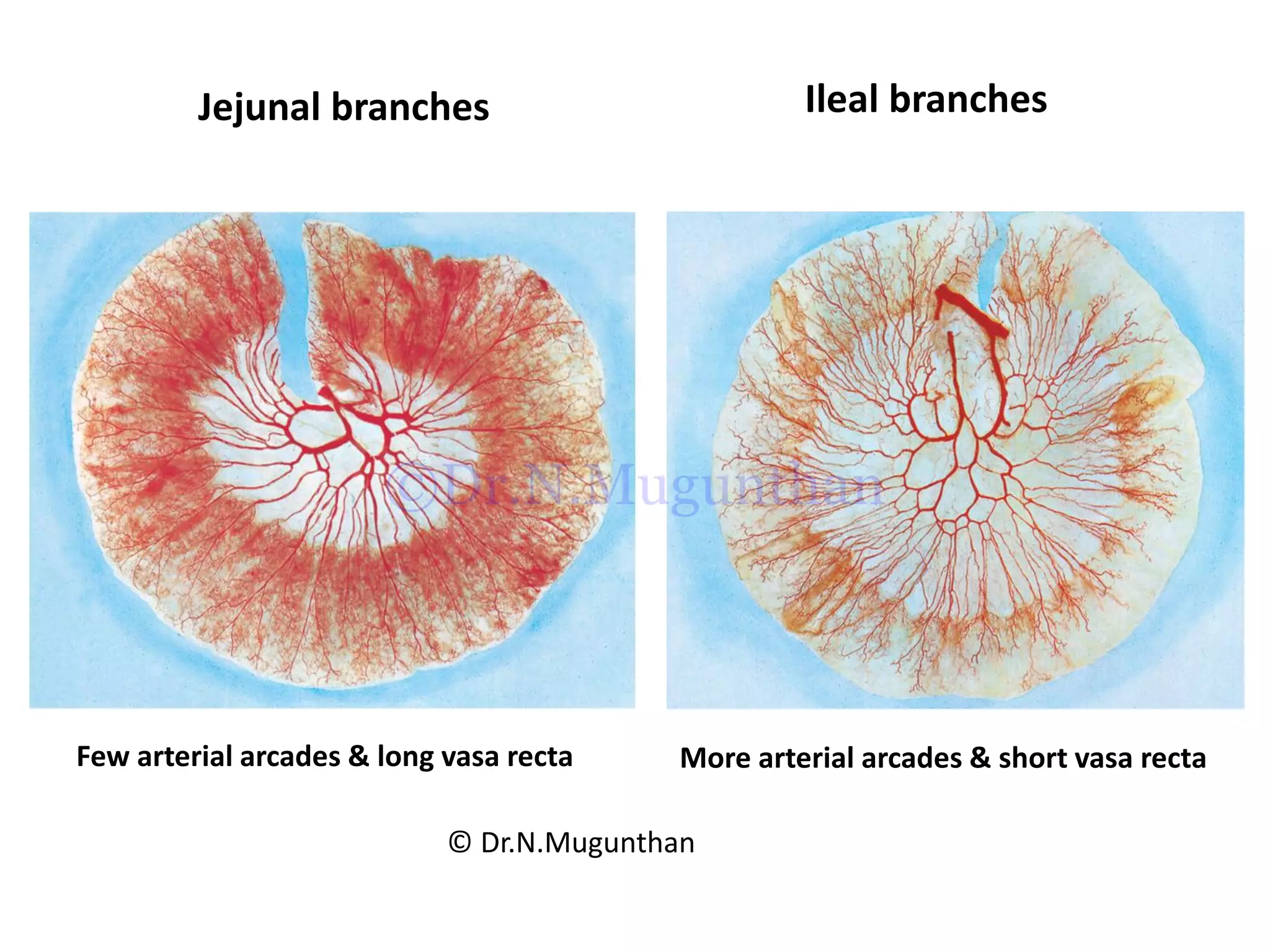 Jejunal branches Ileal branches
Few arterial arcades & long vasa recta More arterial arcades & short vasa recta
© Dr.N.Mugunthan
©Dr.N.Mugunthan
 