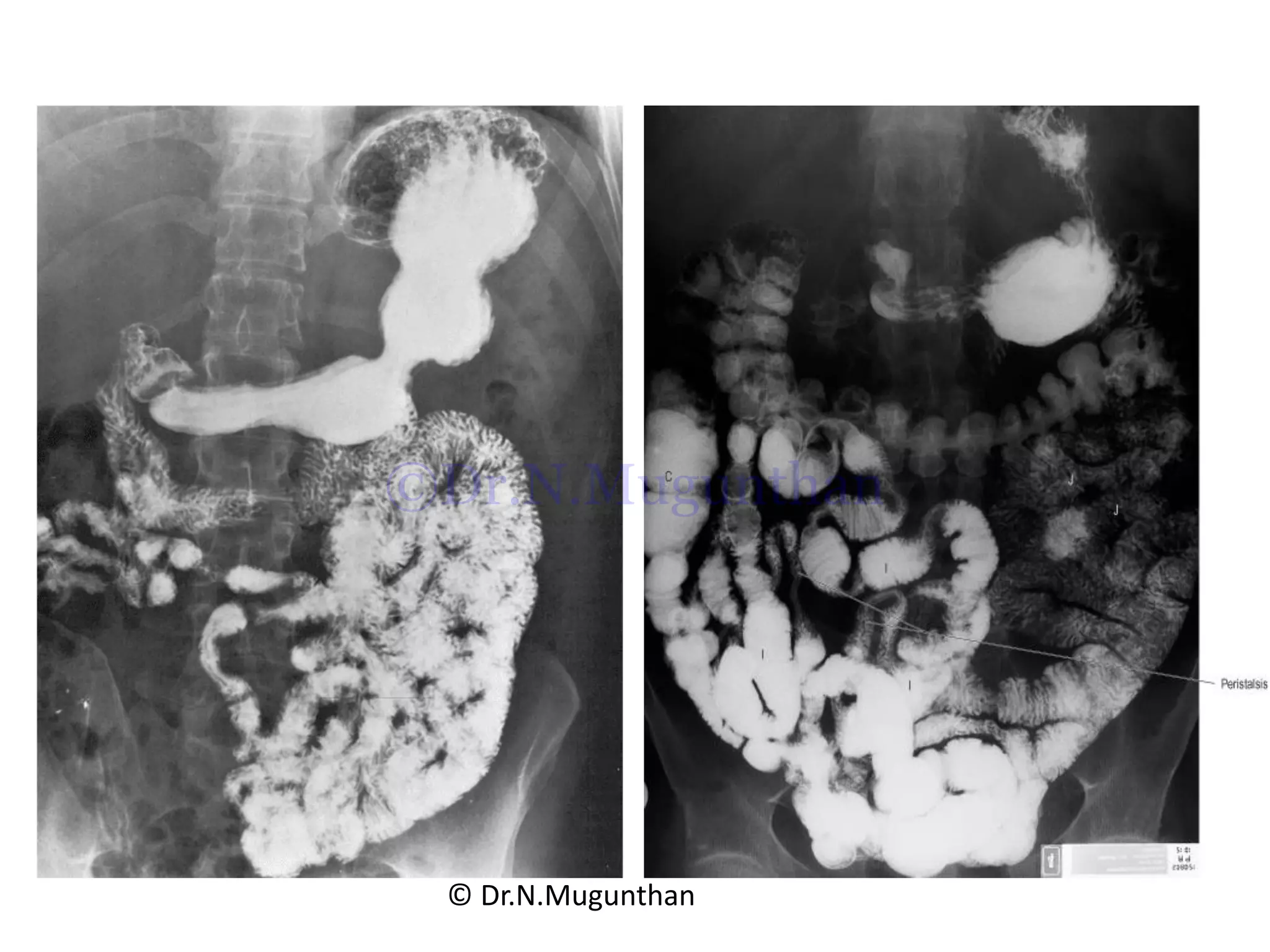 © Dr.N.Mugunthan
©Dr.N.Mugunthan
 