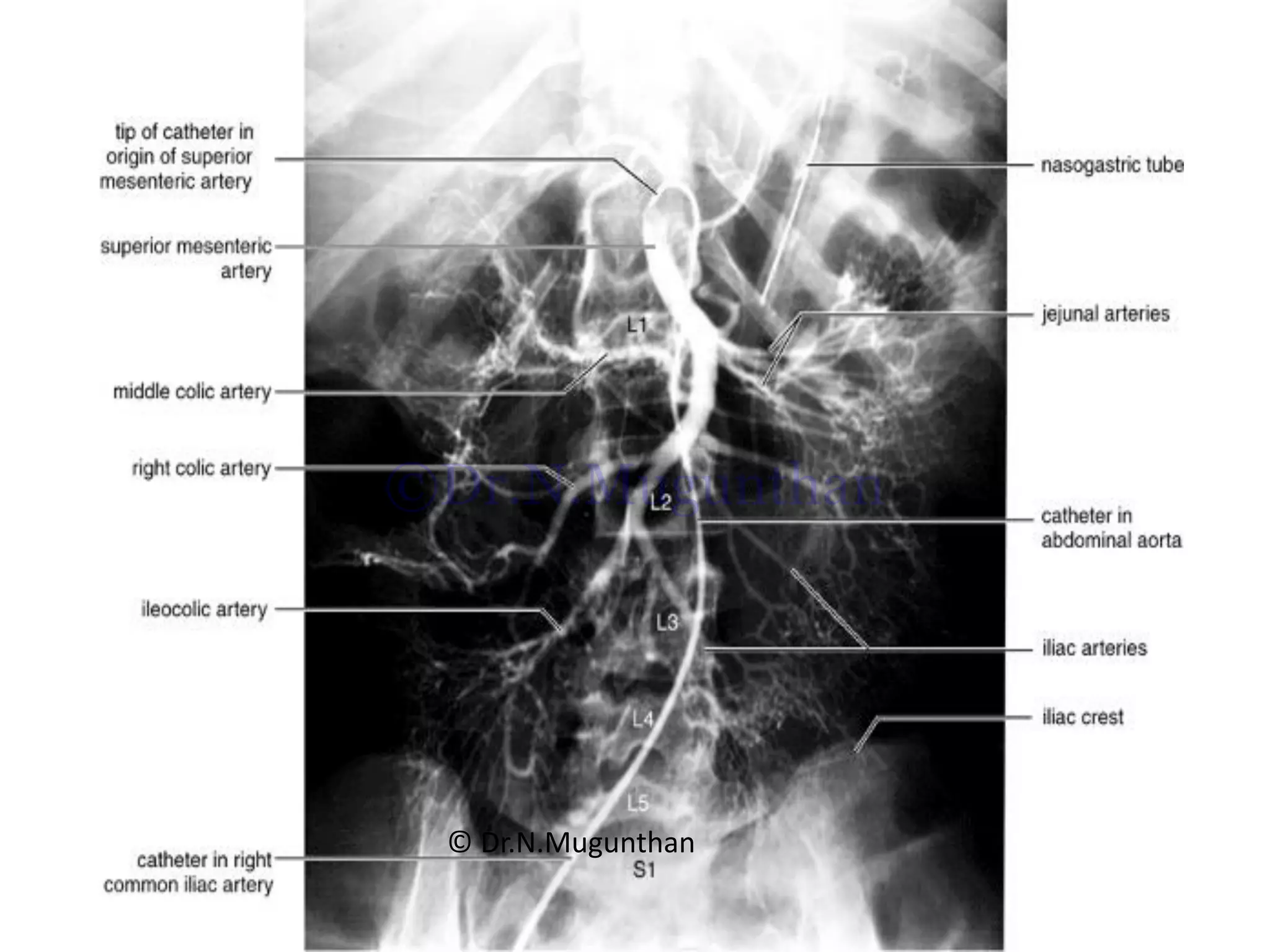 © Dr.N.Mugunthan
©Dr.N.Mugunthan
 