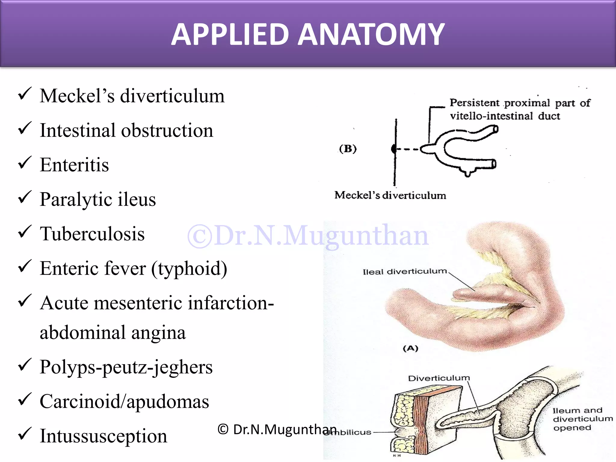 APPLIED ANATOMY
 Meckel’s diverticulum
 Intestinal obstruction
 Enteritis
 Paralytic ileus
 Tuberculosis
 Enteric fever (typhoid)
 Acute mesenteric infarction-
abdominal angina
 Polyps-peutz-jeghers
 Carcinoid/apudomas
 Intussusception © Dr.N.Mugunthan
©Dr.N.Mugunthan
 