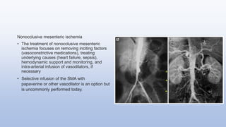 Nonocclusive mesenteric ischemia
• The treatment of nonocclusive mesenteric
ischemia focuses on removing inciting factors
(vasoconstrictive medications), treating
underlying causes (heart failure, sepsis),
hemodynamic support and monitoring, and
intra-arterial infusion of vasodilators, if
necessary
• Selective infusion of the SMA with
papaverine or other vasodilator is an option but
is uncommonly performed today.
 