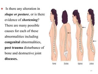 ♠ Is there any alteration in
shape or posture, or is there
evidence of shortening?
There are many possible
causes for each of these
abnormalities including
congenital abnormalities,
post trauma disturbance of
bone and destructive joint
diseases.
26
 