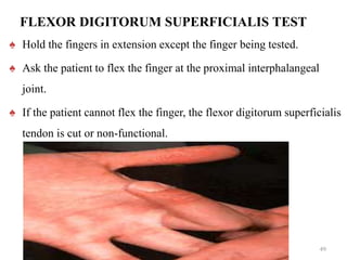 FLEXOR DIGITORUM SUPERFICIALIS TEST
♠ Hold the fingers in extension except the finger being tested.
♠ Ask the patient to flex the finger at the proximal interphalangeal
joint.
♠ If the patient cannot flex the finger, the flexor digitorum superficialis
tendon is cut or non-functional.
49
 