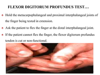 FLEXOR DIGITORUM PROFUNDUS TEST…
♠ Hold the metacarpophalangeal and proximal interphalangeal joints of
the finger being tested in extension.
♠ Ask the patient to flex the finger at the distal interphalangeal joint.
♠ If the patient cannot flex the finger, the flexor digitorum profundus
tendon is cut or non-functional.
50
 