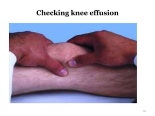 Checking knee effusion
55
 