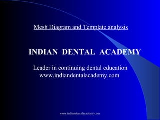 Mesh Diagram and Template analysis

INDIAN DENTAL ACADEMY
Leader in continuing dental education
www.indiandentalacademy.com

www.indiandentalacademy.com

 