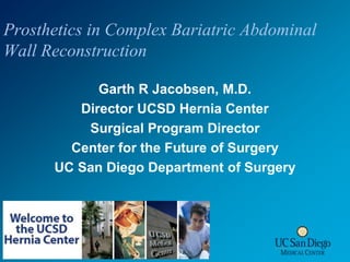 Prosthetics in Complex Bariatric Abdominal Wall Reconstruction Garth R Jacobsen, M.D. Director UCSD Hernia Center Surgical Program Director Center for the Future of Surgery UC San Diego Department of Surgery 