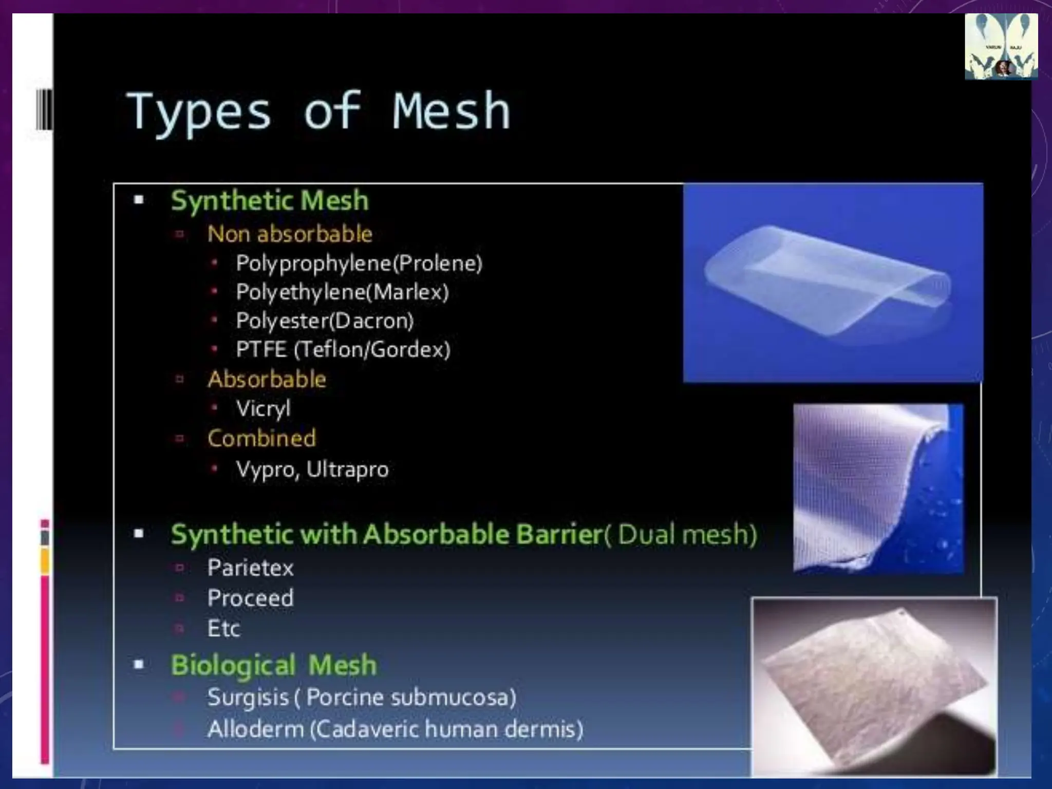 MESHES AND METHODS OF FIXATION.pptx