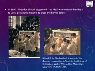 • In 1890 - Theodor Billroth suggested “the ideal way to repair hernias is
to use a prosthetic material to close the hernia defect”
Billroth T. In: The Medical Sciences in the
German Universities: A Study in the History of
Civilization. Welch W.H., editor. Macmillan;
New York, NY, USA: 1924.
 