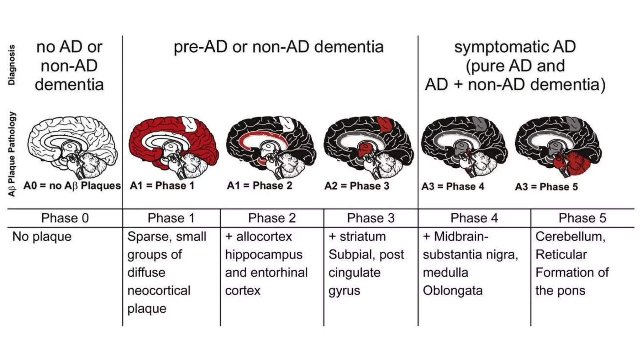 MESIAL TEMPORAL ALZHEIMER DISEASE P.pptx