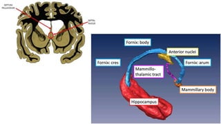 MESIAL TEMPORAL ALZHEIMER DISEASE P.pptx