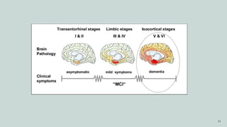 MESIAL TEMPORAL ALZHEIMER DISEASE P.pptx