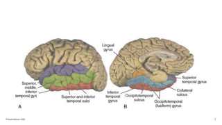 MESIAL TEMPORAL ALZHEIMER DISEASE P.pptx