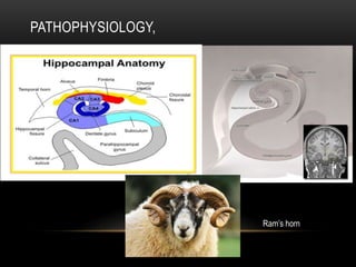 PATHOPHYSIOLOGY,
Ram’s horn
 
