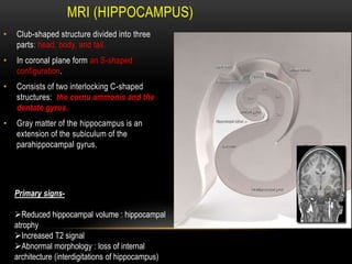 MRI (HIPPOCAMPUS)
• Club-shaped structure divided into three
parts: head, body, and tail.
• In coronal plane form an S-shaped
configuration.
• Consists of two interlocking C-shaped
structures: the cornu ammonis and the
dentate gyrus.
• Gray matter of the hippocampus is an
extension of the subiculum of the
parahippocampal gyrus.
Primary signs-
Reduced hippocampal volume : hippocampal
atrophy
Increased T2 signal
Abnormal morphology : loss of internal
architecture (interdigitations of hippocampus)
 