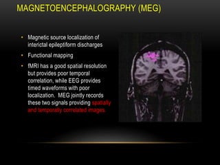 MAGNETOENCEPHALOGRAPHY (MEG)
• Magnetic source localization of
interictal epileptiform discharges
• Functional mapping
• fMRI has a good spatial resolution
but provides poor temporal
correlation, while EEG provides
timed waveforms with poor
localization. MEG jointly records
these two signals providing spatially
and temporally correlated images.
 