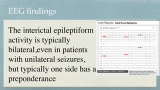 EEG
fi
ndings
The interictal epileptiform
activity is typically
bilateral,even in patients
with unilateral seizures,
but typically one side has a
preponderance
 