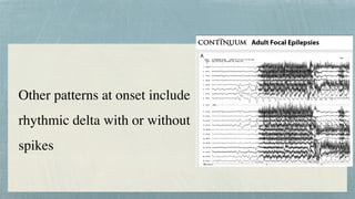 Other patterns at onset include
rhythmic delta with or without
spikes
 