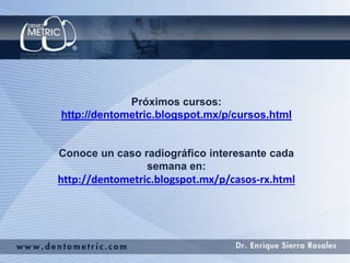 Próximos cursos:
http://dentometric.blogspot.mx/p/cursos.html
Conoce un caso radiográfico interesante cada
semana en:
http://dentometric.blogspot.mx/p/casos-rx.html