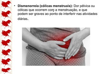 .
• Dismenorreia (cólicas menstruais): Dor pélvica ou
cólicas que ocorrem com a menstruação, e que
podem ser graves ao ponto de interferir nas atividades
diárias.
 