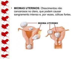 .
• MIOMAS UTERINOS: Crescimentos não
cancerosos no útero, que podem causar
sangramento intenso e, por vezes, cólicas fortes.
 