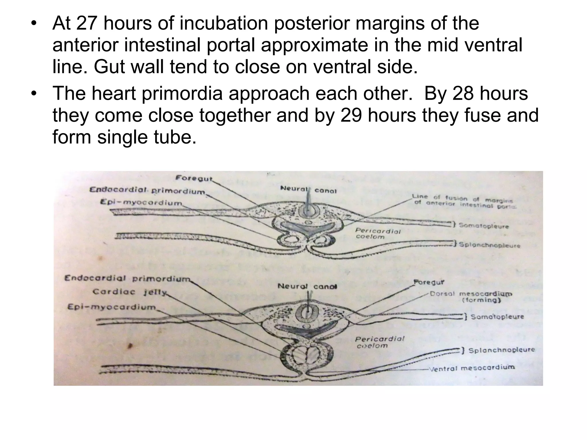 • At 27 hours of incubation posterior margins of the
anterior intestinal portal approximate in the mid ventral
line. Gut wall tend to close on ventral side.
• The heart primordia approach each other. By 28 hours
they come close together and by 29 hours they fuse and
form single tube.
 
