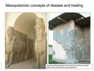 Mesopotamian concepts of disease and healing Assyrian palace gateways were flanked by protective winged bulls to drive away illness carrying demons. 