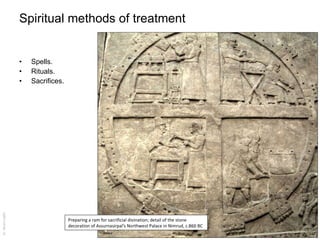 Mesopotamian medicine Slide 26
