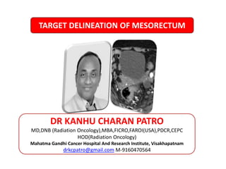 MANAGEMENT OF DIFFUSE GLIOMAS
5/11/2023 1
DR KANHU CHARAN PATRO
MD,DNB (Radiation Oncology),MBA,FICRO,FAROI(USA),PDCR,CEPC
HOD(Radiation Oncology)
Mahatma Gandhi Cancer Hospital And Research Institute, Visakhapatnam
drkcpatro@gmail.com M-9160470564
TARGET DELINEATION OF MESORECTUM
 