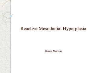 Reactive Mesothelial Hyperplasia
Rawa Muhsin
 