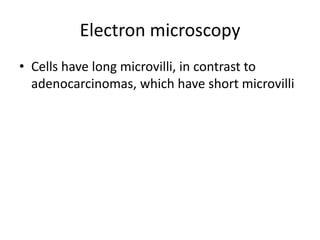 Electron microscopy
• Cells have long microvilli, in contrast to
adenocarcinomas, which have short microvilli
 