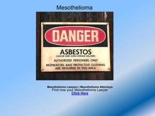 Mesothelioma




Mesothelioma Lawyers | Mesothelioma Attorneys
   Find now your Mesothelioma Lawyer
               Click Here
 