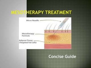 Mesotherapy treatment  Concise Guide 