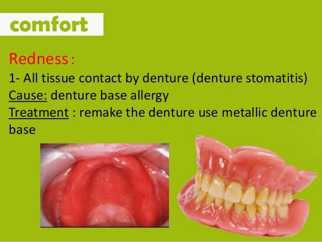 post insertion proplem in complete denture 2016