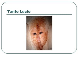 Tante Lucie