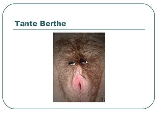 Tante Berthe