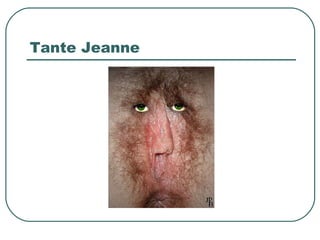 Tante Jeanne