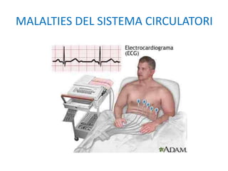 MALALTIES DEL SISTEMA CIRCULATORI
 