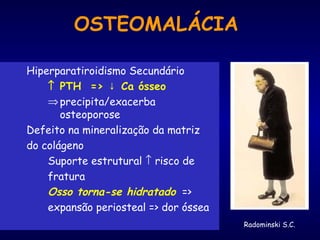 OSTEOMALÁCIA
Hiperparatiroidismo Secundário
↑ PTH => Ca ósseo↓
⇒precipita/exacerba
osteoporose
Defeito na mineralização da matriz
do colágeno
Suporte estrutural ↑ risco de
fratura
Osso torna-se hidratado =>
expansão periosteal => dor óssea
Radominski S.C.
 