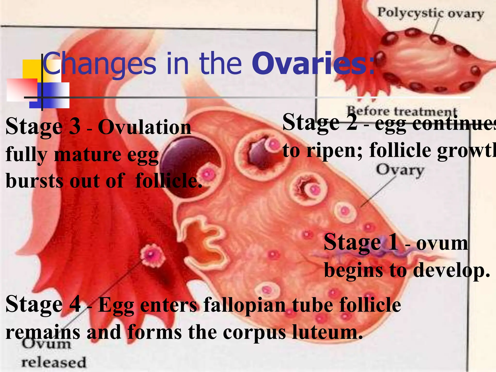 Changes in the Ovaries:
Stage 1 - ovum
begins to develop.
Stage 2 - egg continues
to ripen; follicle growth
Stage 3 - Ovulation
fully mature egg
bursts out of follicle.
Stage 4 - Egg enters fallopian tube follicle
remains and forms the corpus luteum.
 