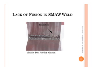 LACK OF FUSION IN SMAW WELD
Indication
ME312
NDT_SUKESH
O
P/
APME/JECC
Visible, Dry Powder Method
23
ME312
NDT_SUKESH
O
P/
APME/JECC
 