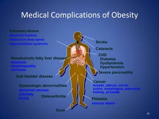 Medical Complications of ObesityPulmonary diseaseabnormal functionobstructive sleep apneahypoventilation syndrome32StrokeCataractsCHDDiabetesDyslipidemia   HypertensionNonalcoholic fatty liver diseasesteatosissteatohepatitiscirrhosisSevere pancreatitisGall bladderdiseaseCancerbreast, uterus, cervixcolon, esophagus, pancreaskidney, prostateGynecologic abnormalitiesabnormal mensesinfertilityPCOSOsteoarthritisPhlebitisvenous stasisGout