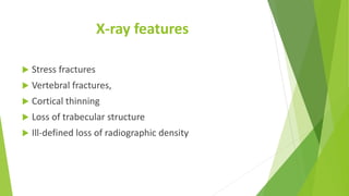 X-ray features
 Stress fractures
 Vertebral fractures,
 Cortical thinning
 Loss of trabecular structure
 Ill-defined loss of radiographic density
 