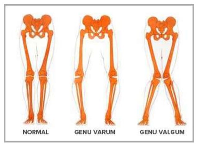 Metabolic Bone Disease PPT