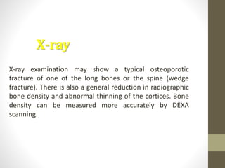 Metabolic bone disease.pptx