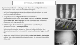 Comprehensive Overview of Metabolic Bone Diseases and Their ...