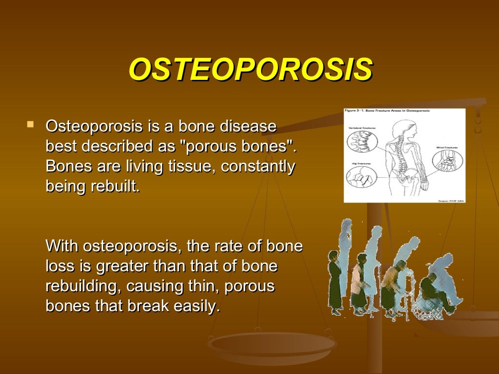 Metabolic Bone Disease