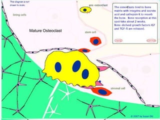 Mature Osteoclast